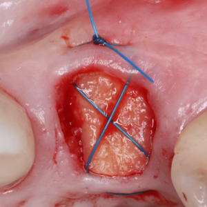 [Translate to Deutsch (Österreich):] 