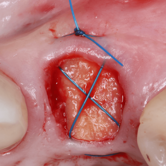 [Translate to Deutsch (Österreich):] 