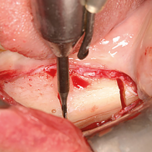 [Translate to Deutsch (Österreich):] 