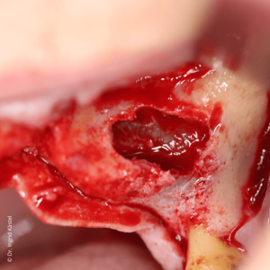 [Translate to Deutsch (Österreich):] 