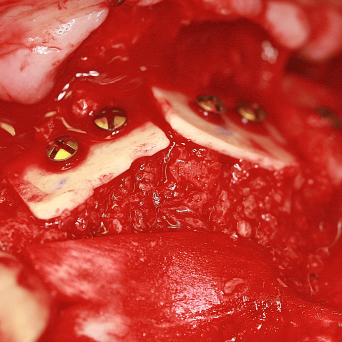 [Translate to Deutsch (Österreich):] 