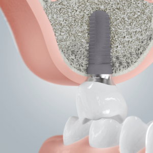 [Translate to Deutsch (Österreich):] 