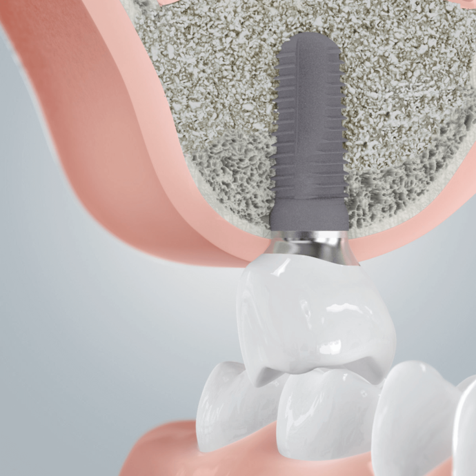 [Translate to Deutsch (Österreich):] 