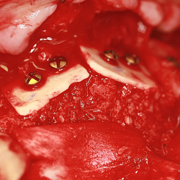 [Translate to Deutsch (Österreich):] 