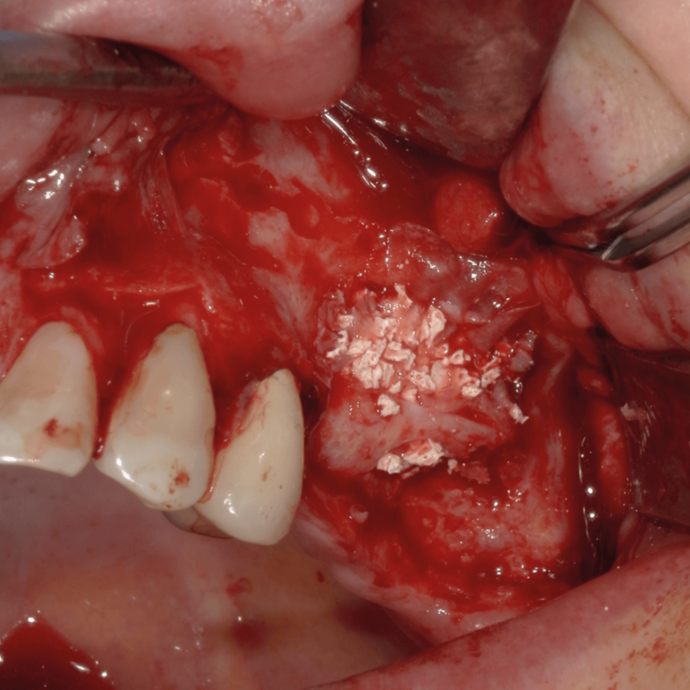 [Translate to Deutsch (Österreich):] 