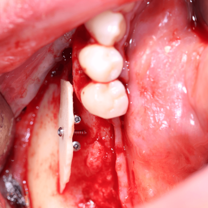 [Translate to Deutsch (Österreich):] 