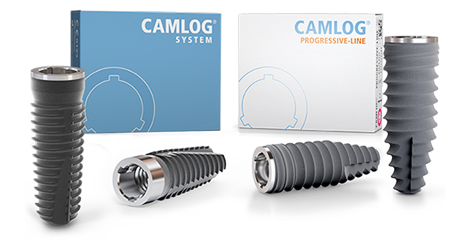 CAMLOG Implantatsystem